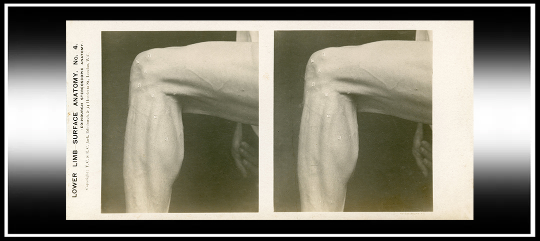 The Applications of Stereoscopy: Medical Training and&nbsp;Visualisation